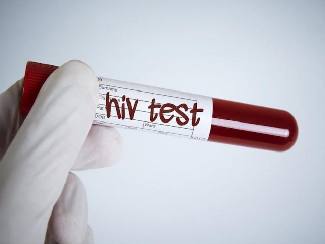 Coronavirus: que lecciones nos dejó el sida, la “peor pandemia de finales del siglo XX”, para hacer frente al covid-19
